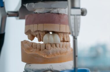 Czy implant zęba można wszczepić w jeden dzień?