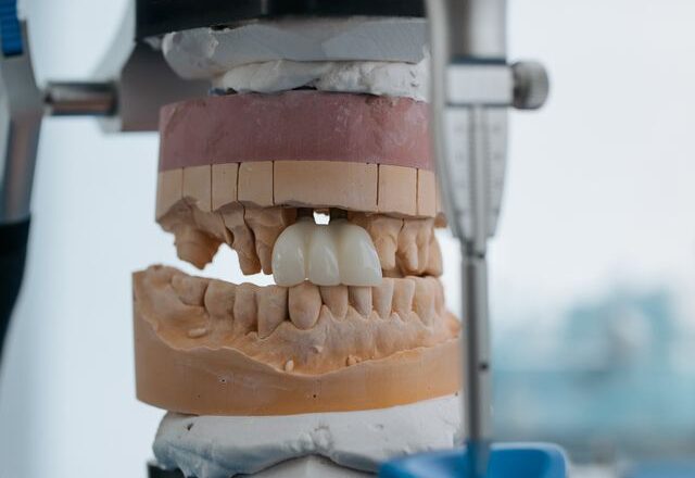 Czy implant zęba można wszczepić w jeden dzień?