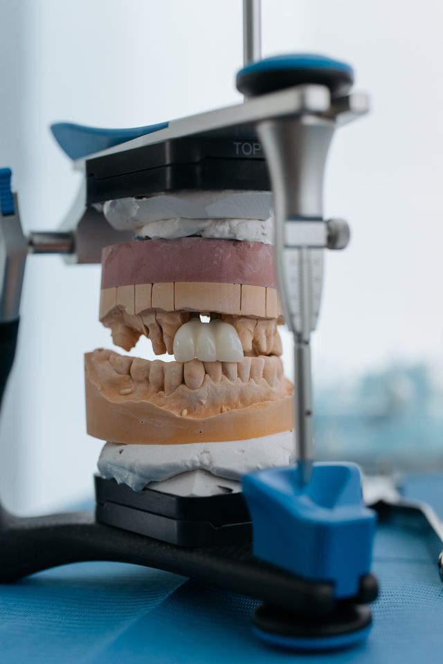Czy implant zęba można wszczepić w jeden dzień?