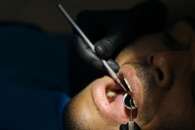 Czy implant zęba może wypaść po dłuższym czasie?